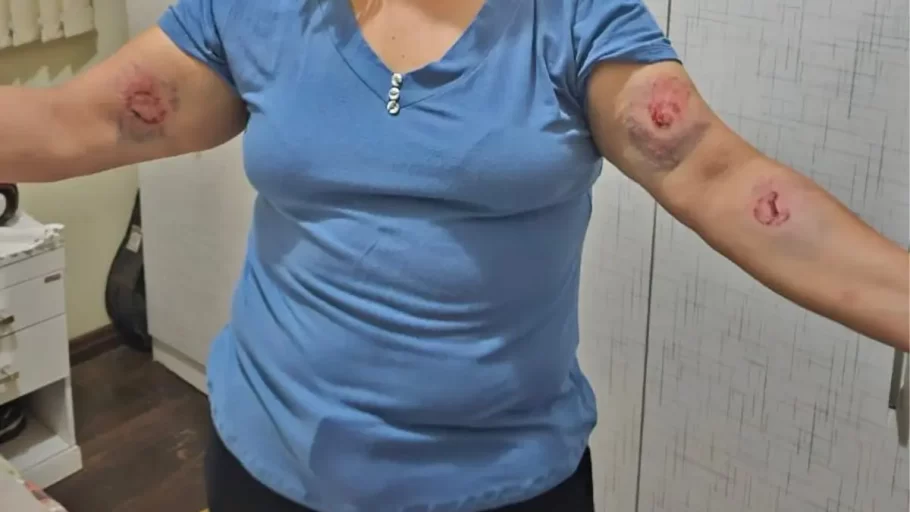 Professora é agredida por aluno em escola estadual de Divinópolis